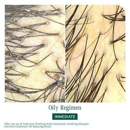 Scalp Sync Purifying Scalp Concentrate - Biolage Renovation NZ | L'Or&eacute;al Partner Shop